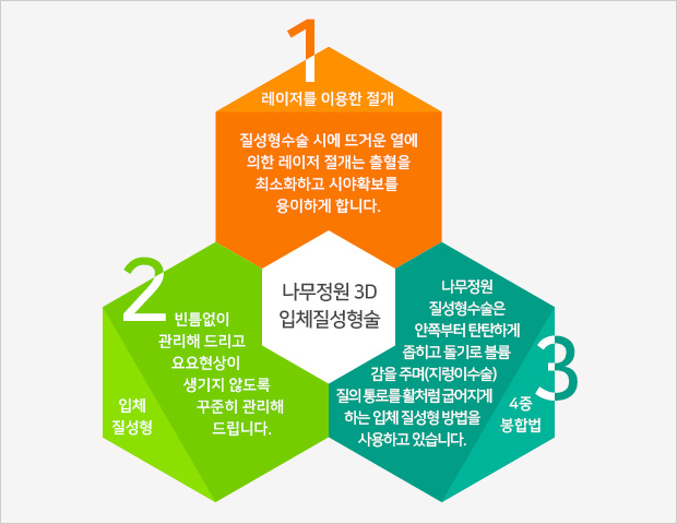 질성형 사진