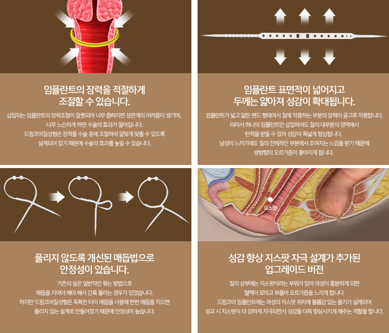 질성형 사진