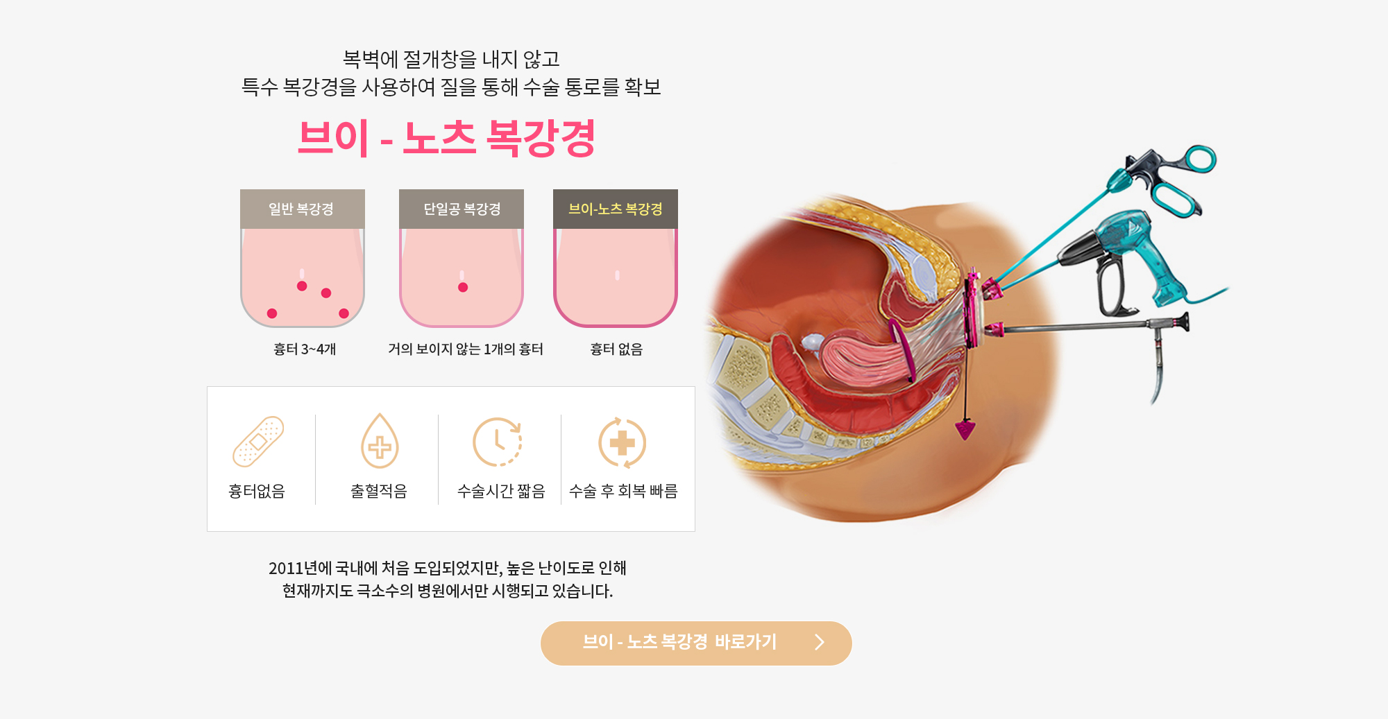 브이노츠 바로가기